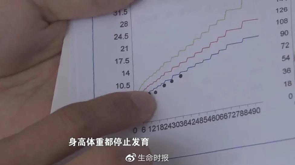 假奶粉喝出的大头娃,假奶粉从包装上能识别出来吗