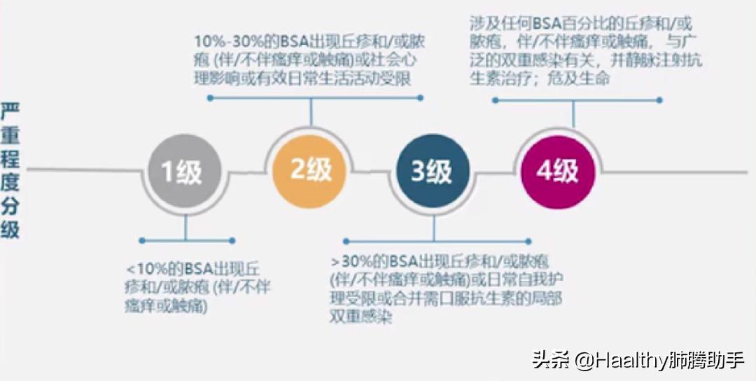 专家谈中医治疗肺癌方法,肺癌晚期放疗有什么副作用和危害
