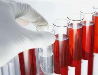 pct偏高会有什么危害,感染性休克为什么pct升高