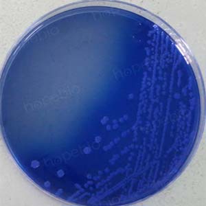 大肠埃希菌培养,大肠埃希菌70%正常吗