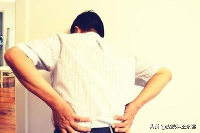 缠腰龙神经痛去医院挂什么科,缠腰龙疼得受不了怎么办