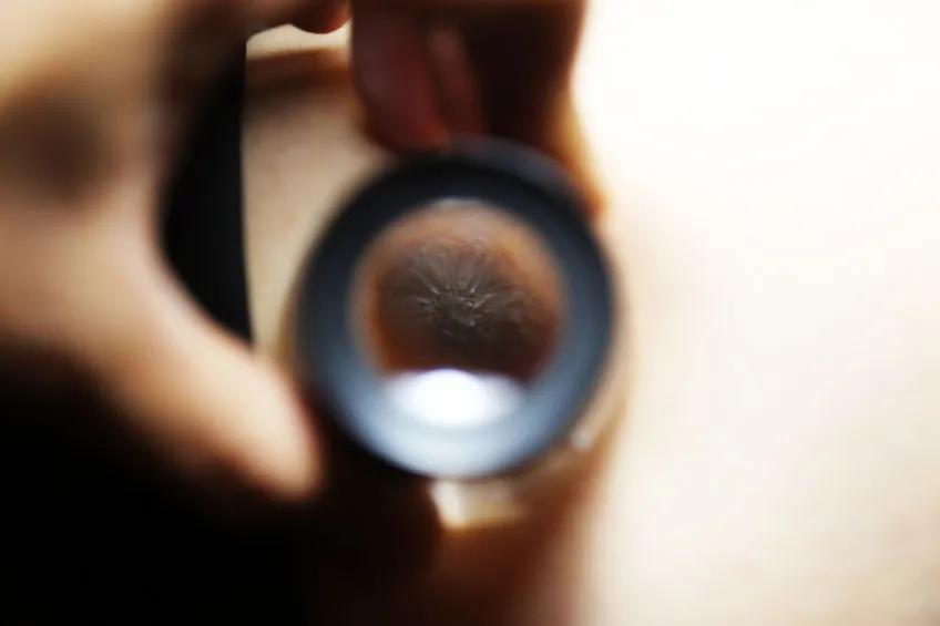 医生提醒这3种痣可能与癌症有关,长在哪些地方的痣都要切