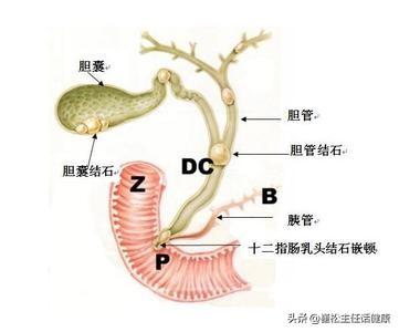 不想去医院第三弹！腹部不适的自我诊察