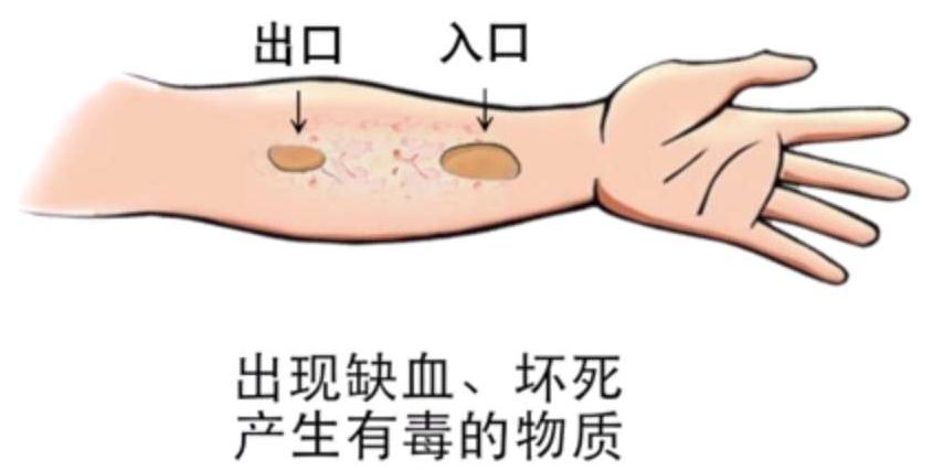 触电的急救处理有什么方法,触电紧急施救方法