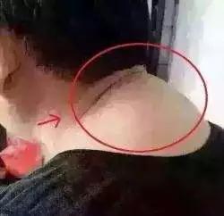 身体“1皱2凸3脏”，多是疾病的信号！希望你别忽视了