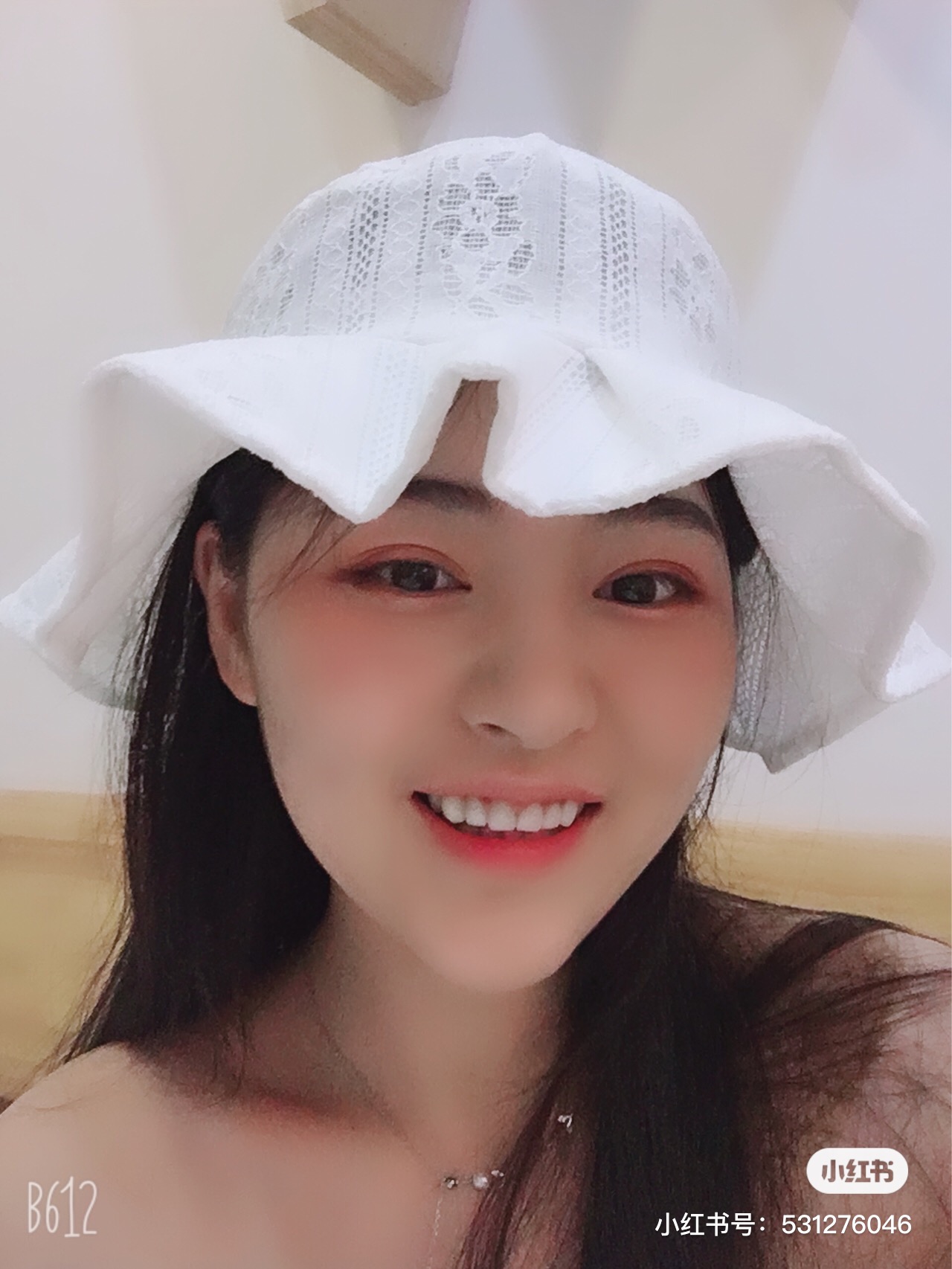 脸上长了一个疮好了又复发,脸上总是长疮反反复复怎么办