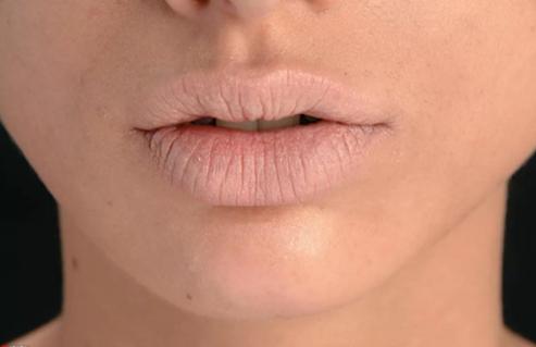 唇纹很严重怎么涂玻璃唇,唇纹重的适合玻璃唇吗