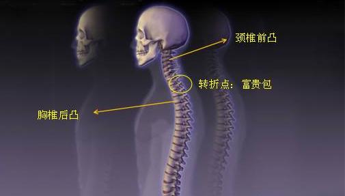 富贵包肩膀脂肪厚怎么消除,富贵包脖子前倾背厚快速消除方法