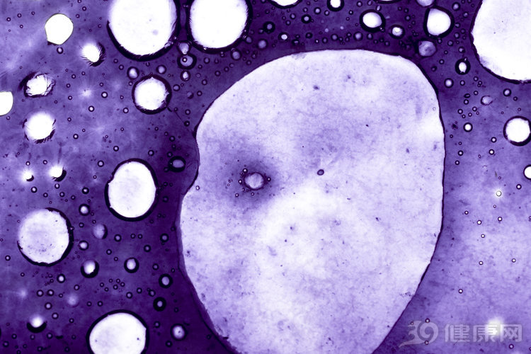 癌细胞扩散身体会出现4种感觉,癌细胞扩散和转移哪个更严重