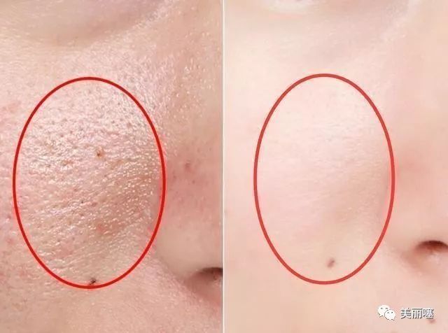 兰蔻粉水屈臣氏官方旗舰店正品,屈臣氏有兰蔻粉水