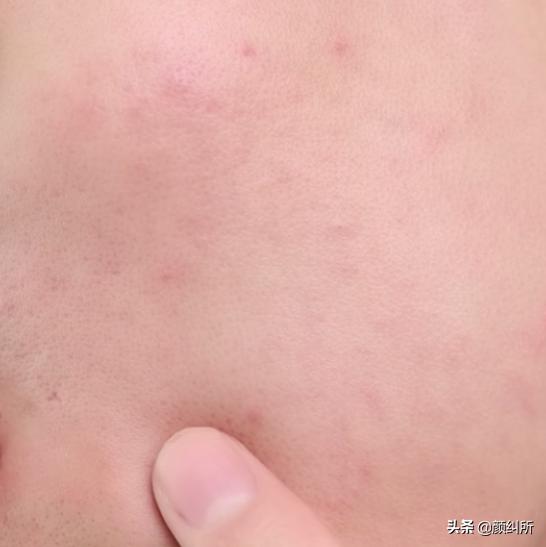 「颜纠所」VT小布丁泥膜，好心机