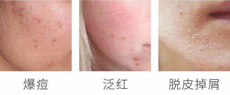 夜间肌肤修复面膜,夜间修护睡眠唇膜