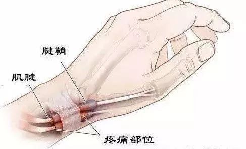 运动员为什么不建议打封闭,打封闭对运动员有什么好处