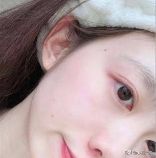 20岁的年纪最容易乱用护肤品，这样护肤才不会变敏感肌