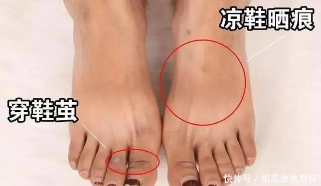 穿拖鞋还能有高品味？时髦又舒适堪比匡威，网友：匡威都out了