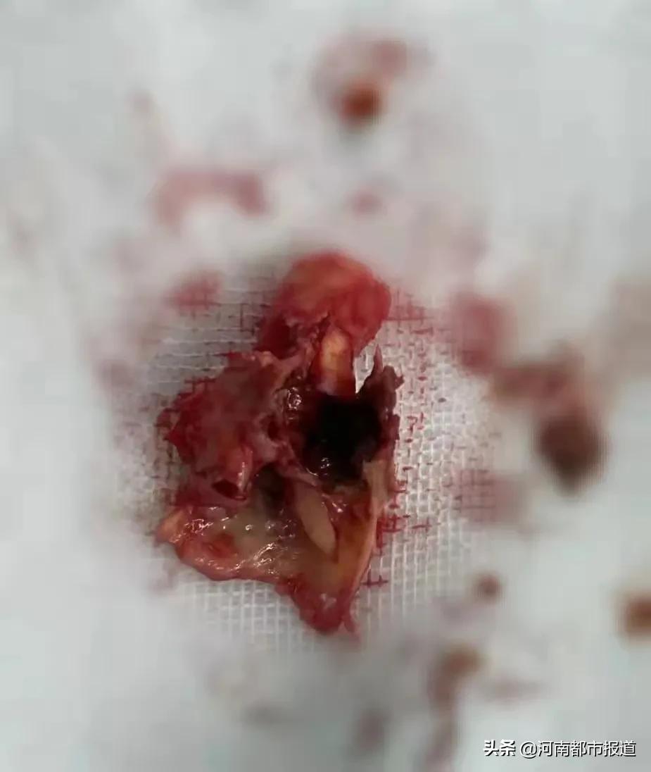 一年晕倒两次怎么恢复,一年内晕倒3次是什么原因