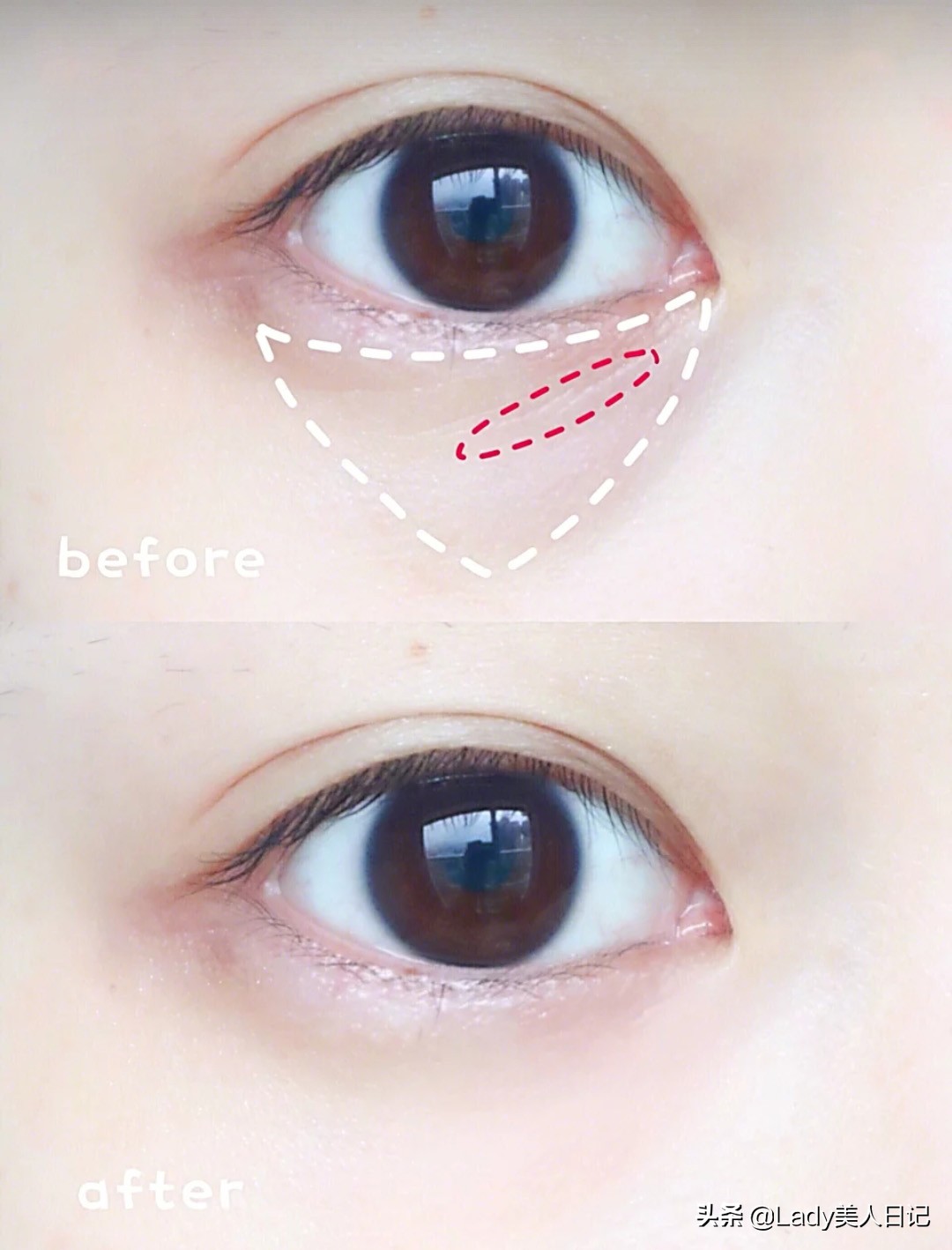 好用的眼霜的正确使用方法,全网最全眼霜的正确使用方法