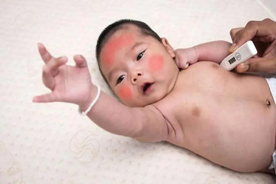 发烧需要居家观察几天,小孩突然发烧要怎么处理