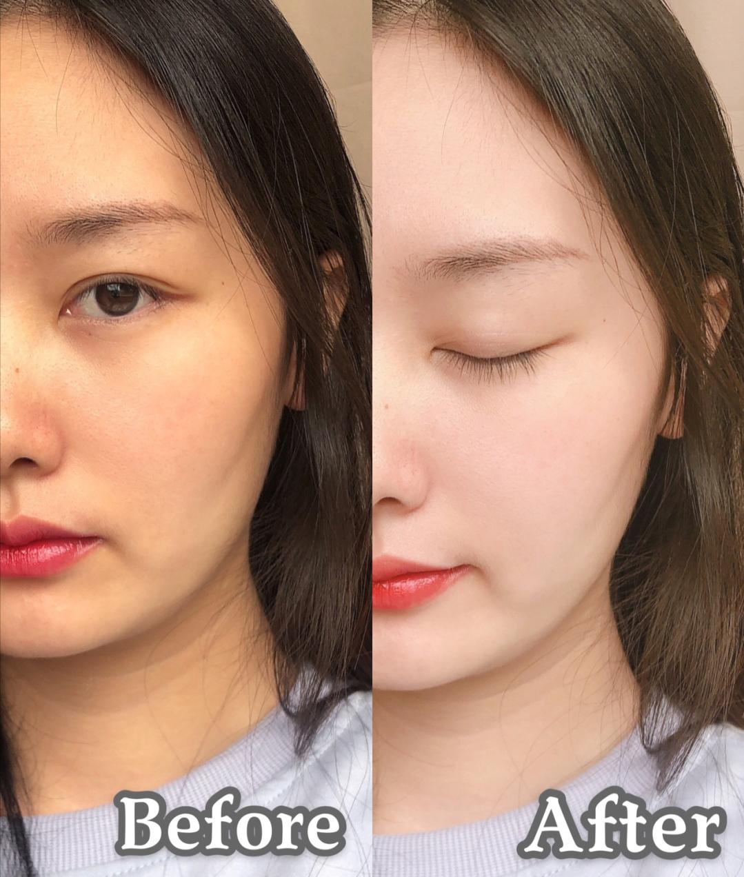 戚薇推荐水乳套装平价,戚薇推荐的水乳油皮