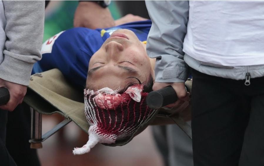 大连队长朱挺,大连球迷朱婷