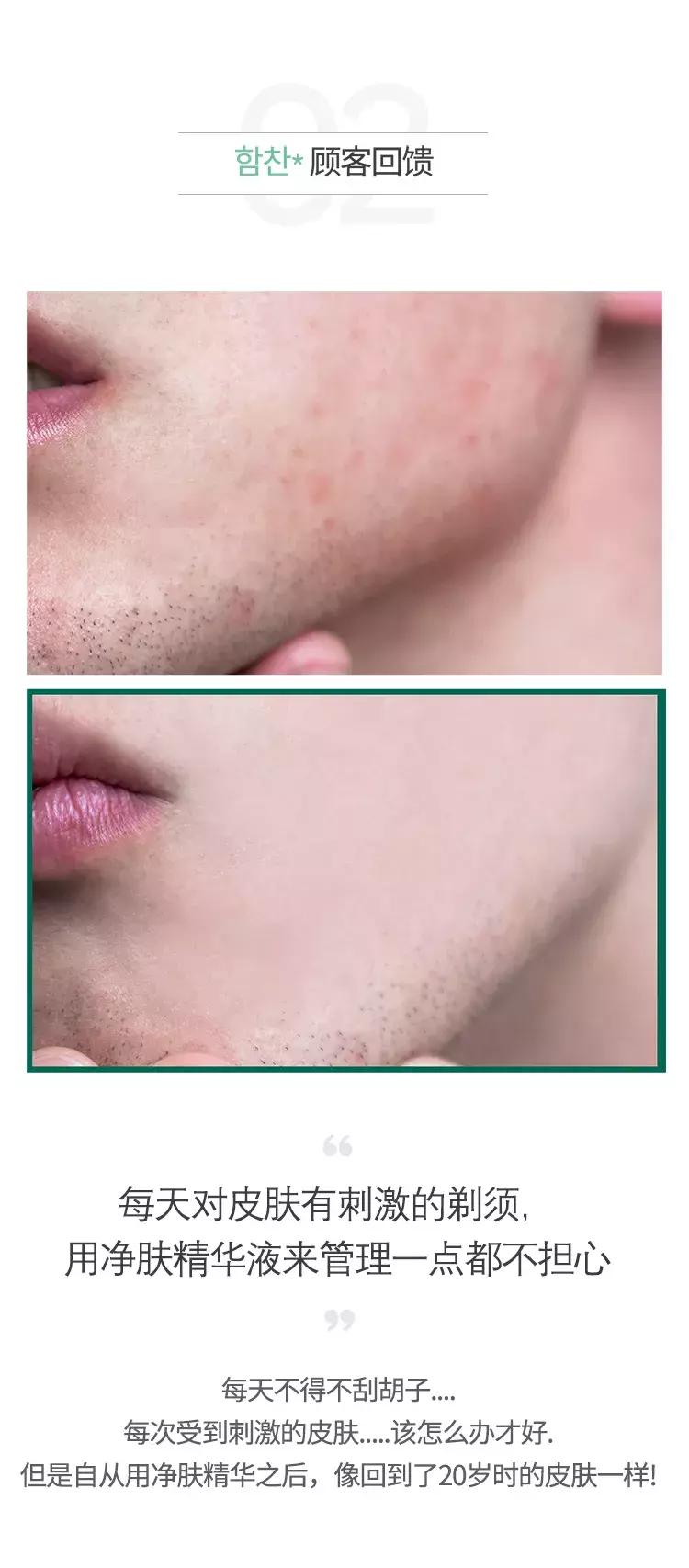 somebymi柚子精华可以祛痘印吗,茶树痘肌修复精华