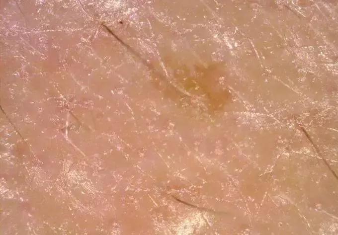 大油皮为啥还起皮,油皮是什么原因导致的怎么解决