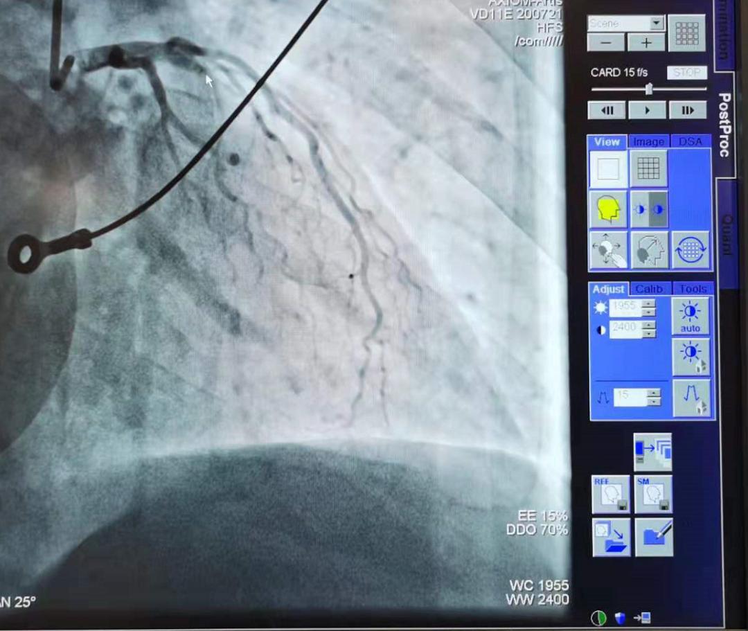 年纪轻轻的心脏不好怎么办,年纪轻轻心脏经常不舒服当心了