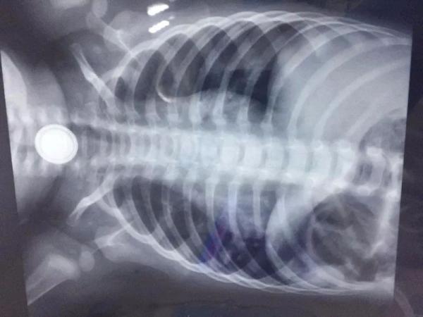 宝宝误吞异物事件,宝宝误吞物品有哪些