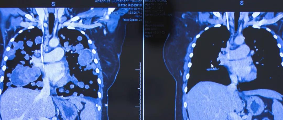 制定最适合肿瘤患者的抗癌方案,2021年肿瘤治疗指南
