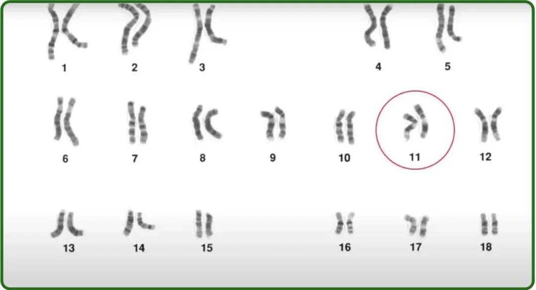 香菜有臭屁虫怎么回事,香菜为什么有臭屁虫的味道