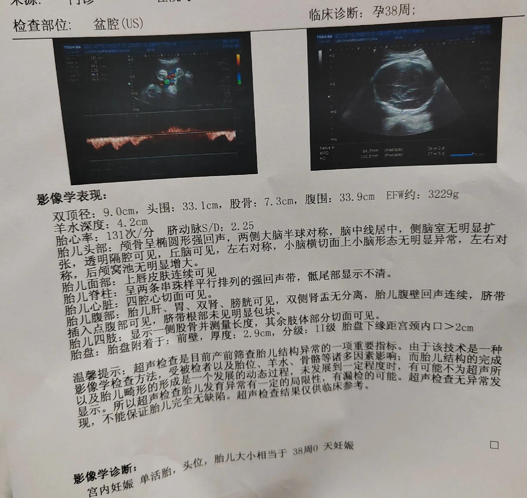 顺利生产过程,顺利当妈妈