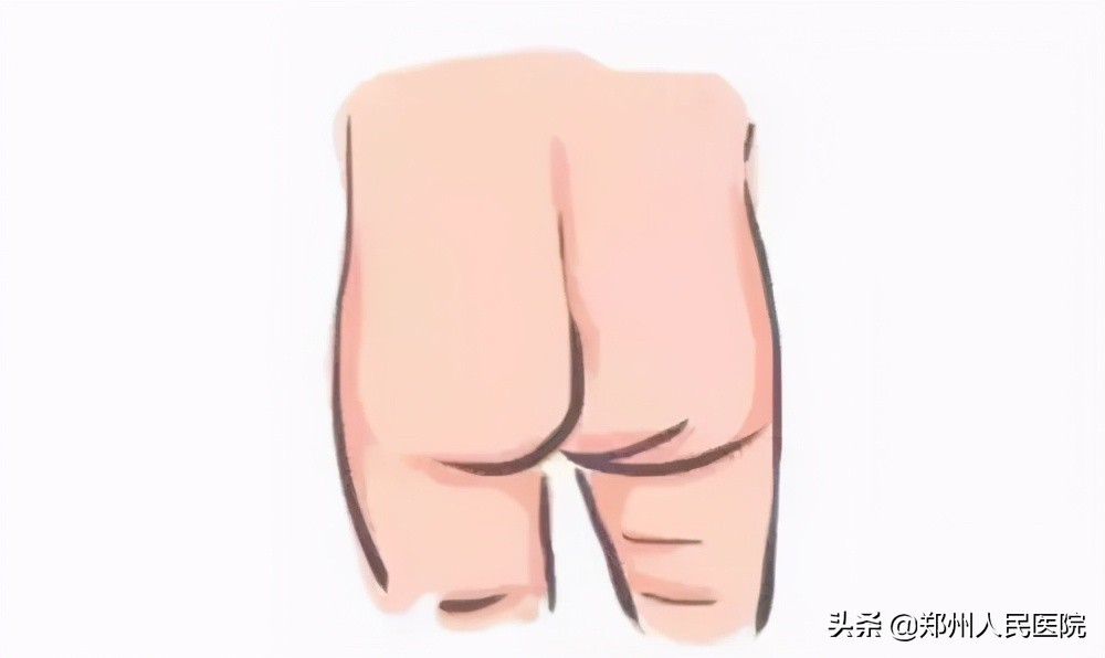 走路像鸭子一样摇摆,走路像鸭子的样子