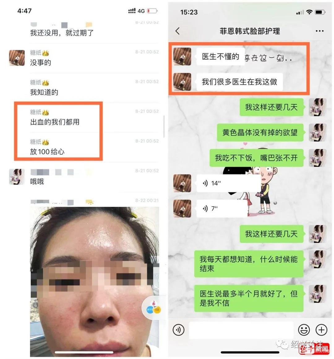 花重金美容变毁容,女子10年花了30多万美容差点毁容