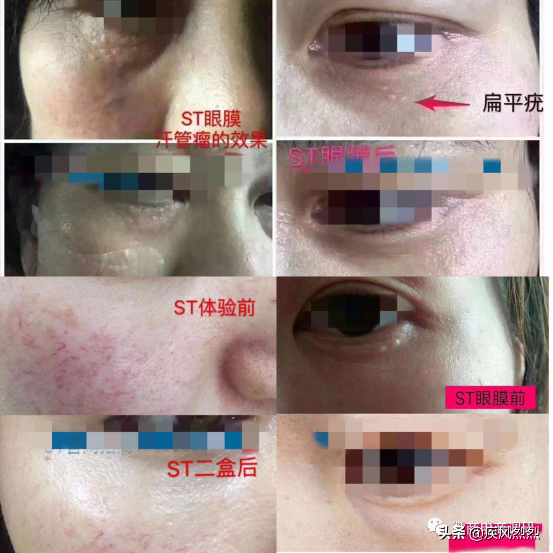 身陷商标纠纷的宾奎国际系列产品到底有多神奇？