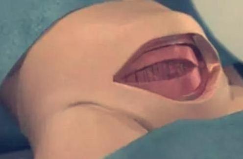 7张图揭露产妇“剖腹产”全过程，男人都该看，网友：母爱太伟大