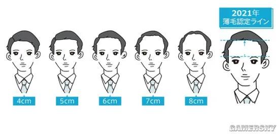 所以秃头的标准是发际线高≥7cm？头秃代表不再是中老年独扛大旗，90后、00后也在积极踊跃加入组织