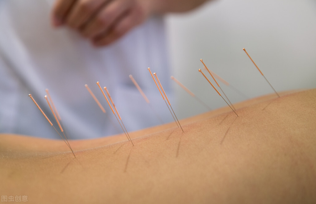 女病人颈肩部疼痛,针灸刺破肺造成气胸,却被老大夫发现另有他症