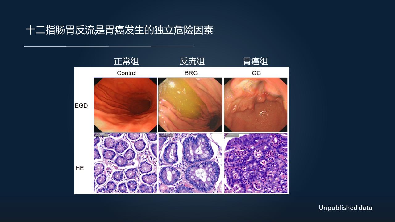 「图文实录」郑晓皎：18分钟详解菌群-胆汁酸与消化系统肿瘤