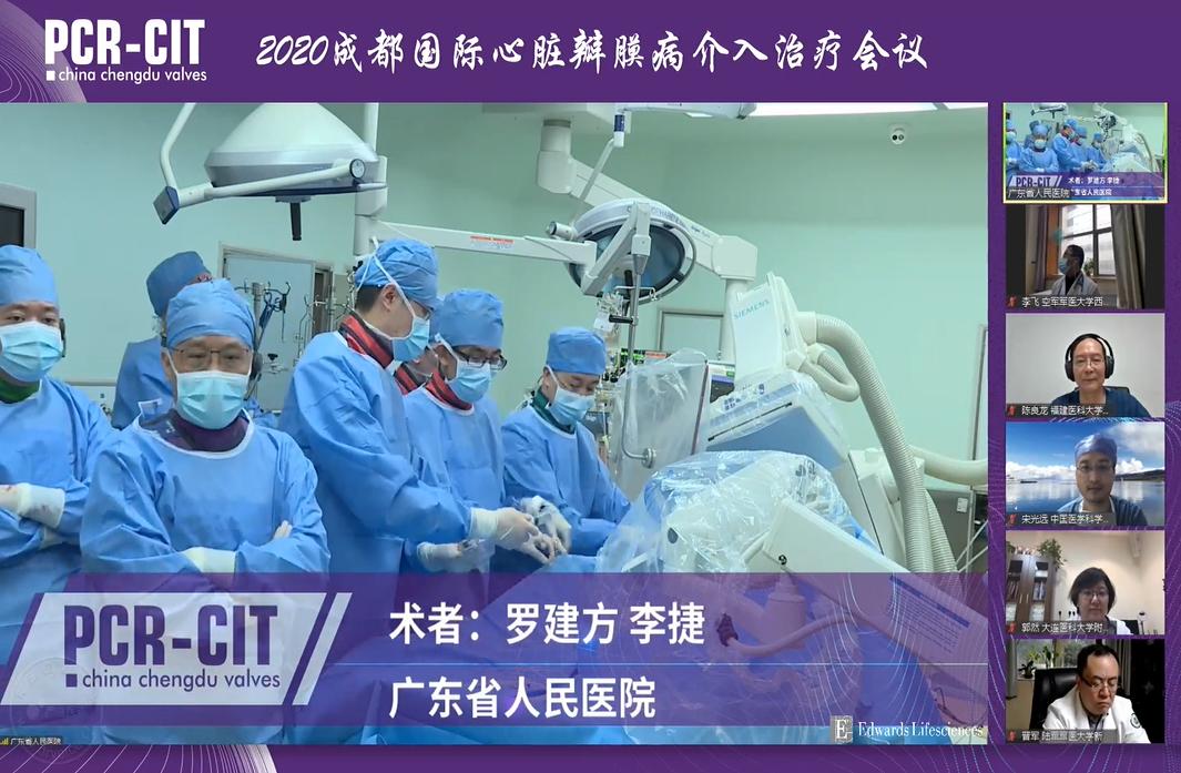 微创人工主动脉瓣膜置换术,微创介入主动脉瓣膜置换术