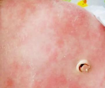 刚出生的宝宝特殊现象,刚出生宝宝吓住了怎么办