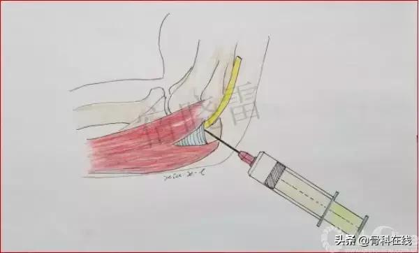手绘科普类,手绘类科普