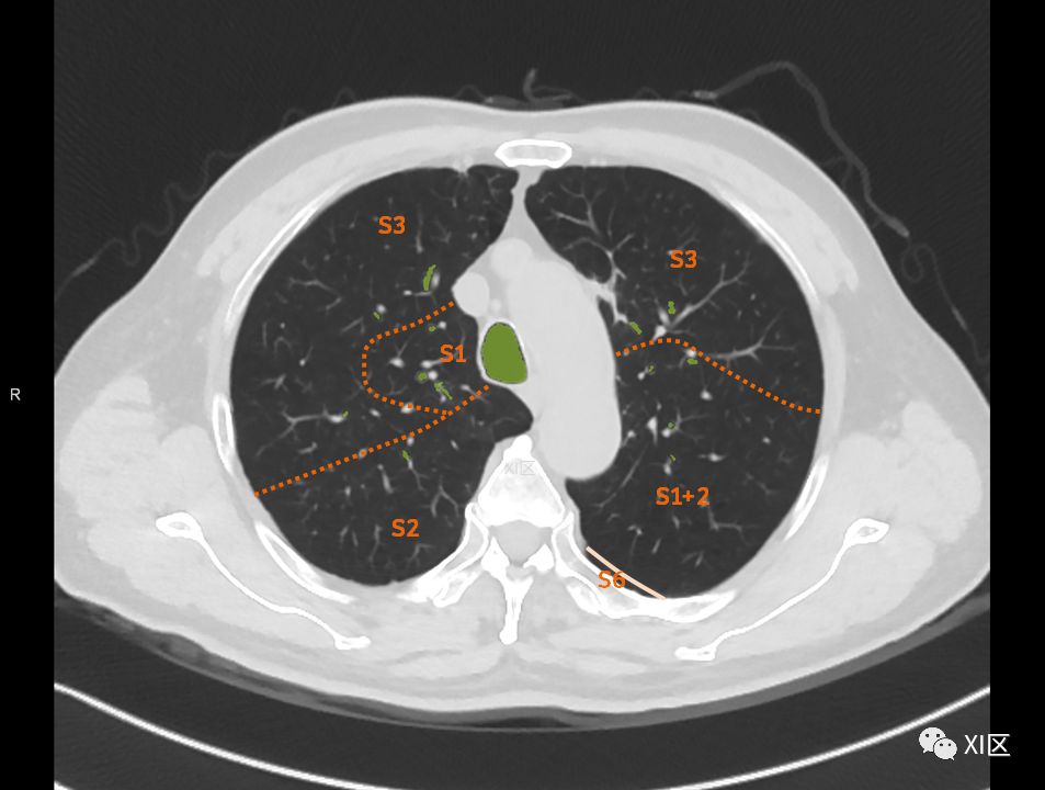 如此详细的肺部影像解剖，有点儿酷！
