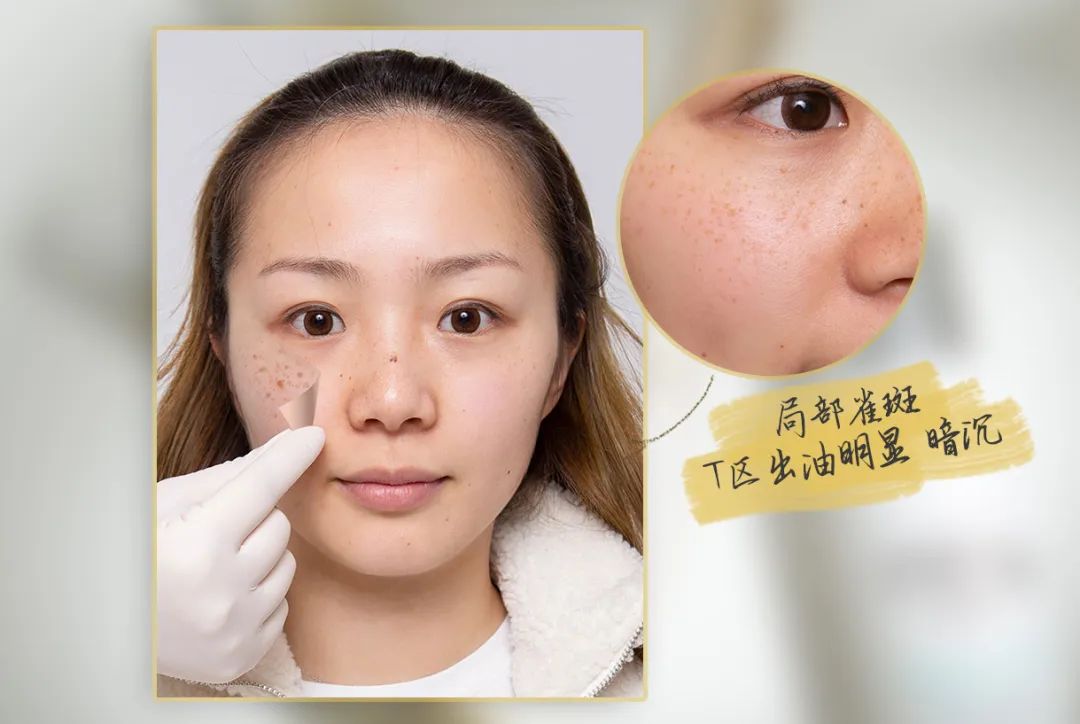 小茂医生美白护肤品,小茂教你如何护肤