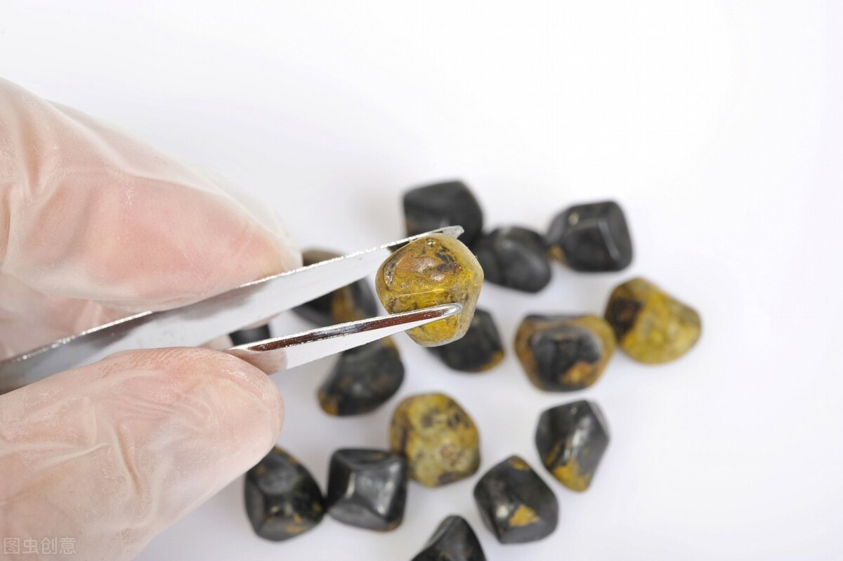 胆囊炎有哪些症状怎样预防胆囊炎,胆囊炎该如何治疗预防和注意事项