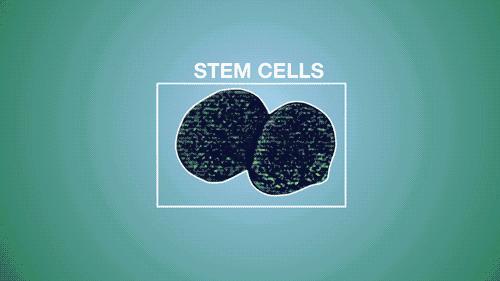 干细胞治疗脑中风效果好吗,干细胞治疗脑中风的最新技术