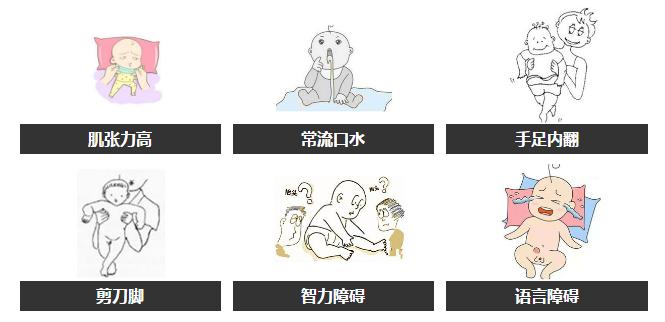 宝宝轻度脑瘫症状是怎么样的,宝宝轻微脑瘫的症状有哪些