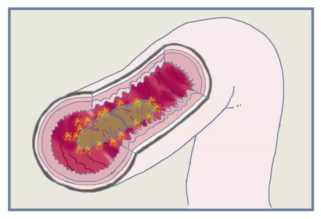 便秘在药店推荐的药品,大家都在用什么药治疗便秘