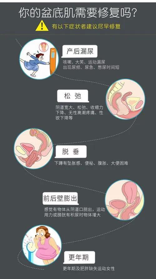 生完孩子尴尬事项,生娃时的尴尬事