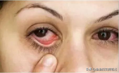 怎么选美瞳和护理美瞳,如何选择美瞳和妆容