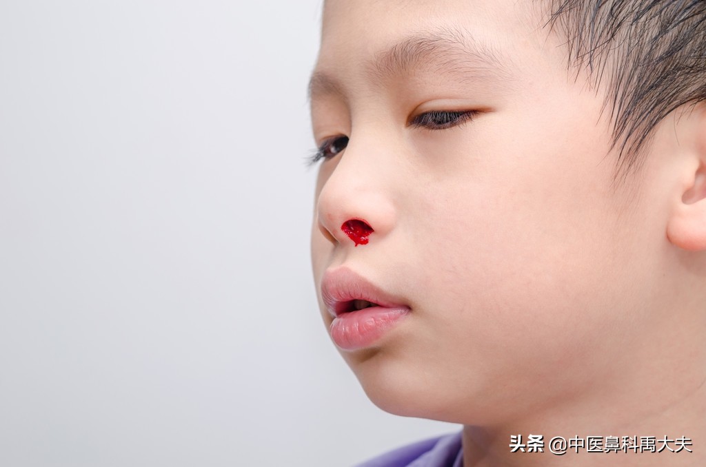 鼻腔出血和鼻膜出血有什么区别,鼻腔出血为什么眼睛里也会出血呢